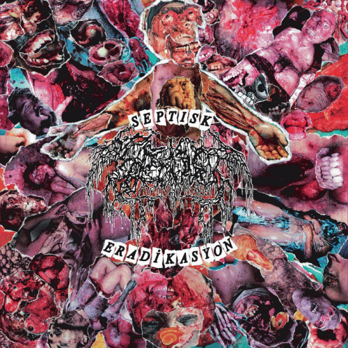 Septage : Septisk Eradikasyon